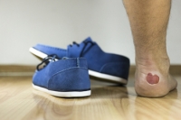 Excess Friction May Cause Blisters