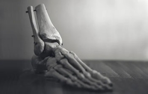 Osteoporosis Prevention