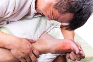 Is Gout Painful?