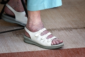 Aging and the Feet