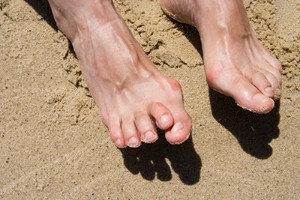 Can Wearing High Heels Cause Hammertoe?